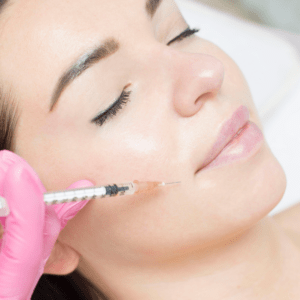 Vampire Facial