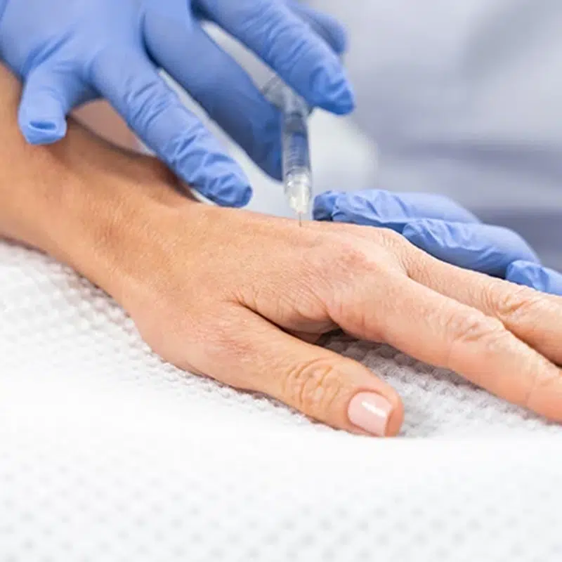 Medical practitioner giving a dermal filler or PRP injection into the back of a patient's hand for skin rejuvenation.